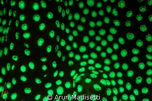 1st attempt at fluorescence. quite frustrating by Arun Madisetti 